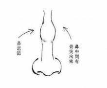 婚姻易有波折的面相特征