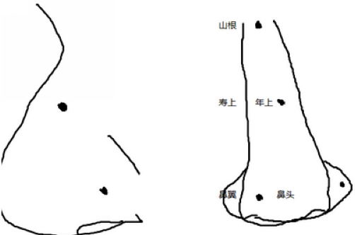 男人鼻子上长痣命运怎么样?