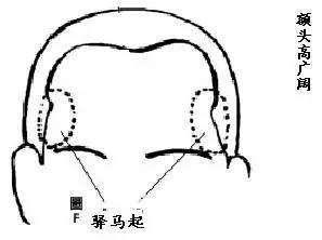 头无异骨，难成贵相