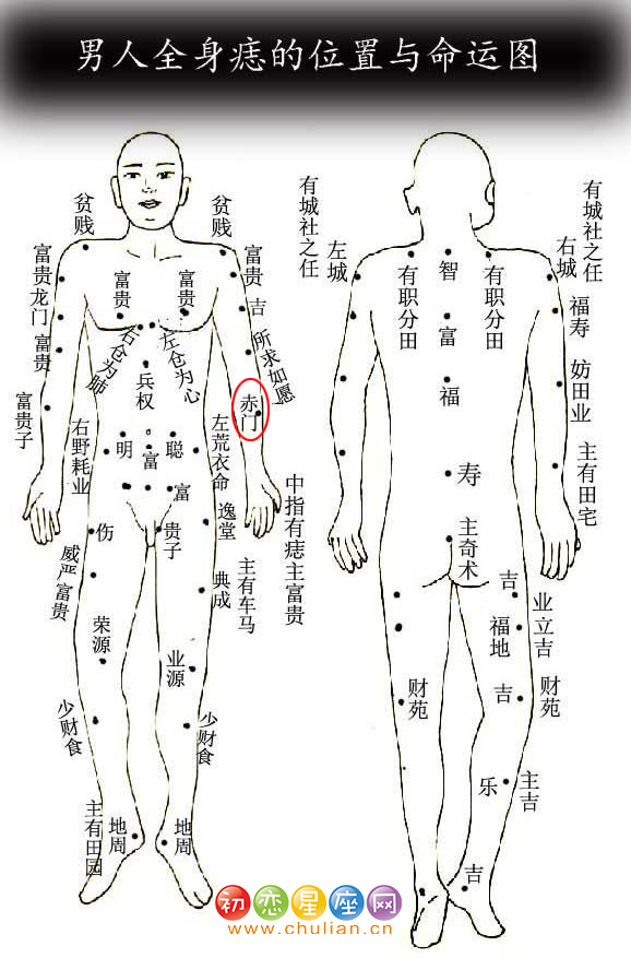 赤门痣