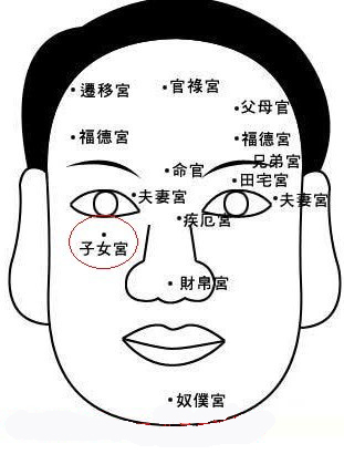 眼袋下面有痣面相眼睛下面有痣