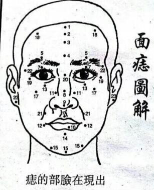 面痣图解，面相基础知识