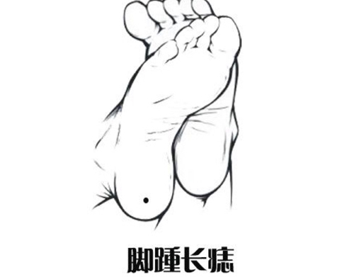 痣相分析：关于男人脚上有痣全图解