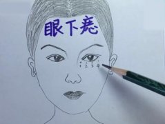 痣相算命：女人眼下长痣命运会如何 你有痣吗