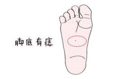 脚上有痣代表什么？脚上有痣好不好？