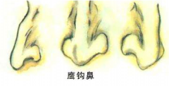 狼心狗肺的面相怎么看