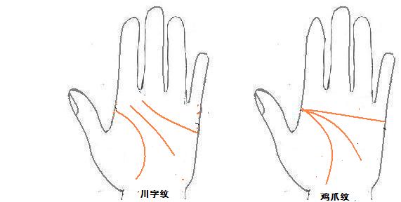 掌纹解析：鸡爪手相的特点